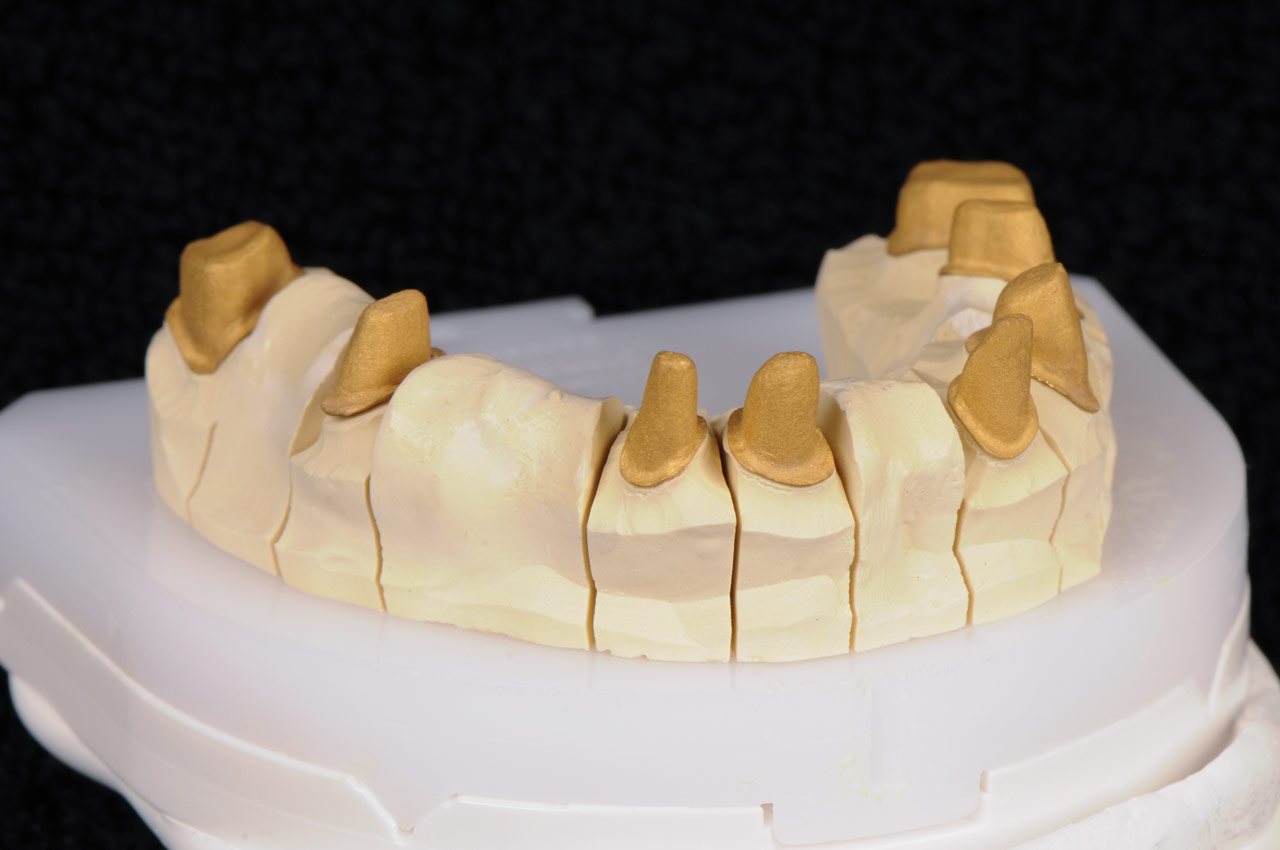 Galvano Käppchen auf Modell