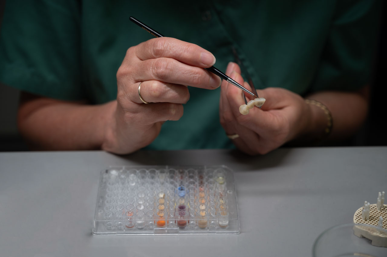 Kronen im Frontzahnbereich