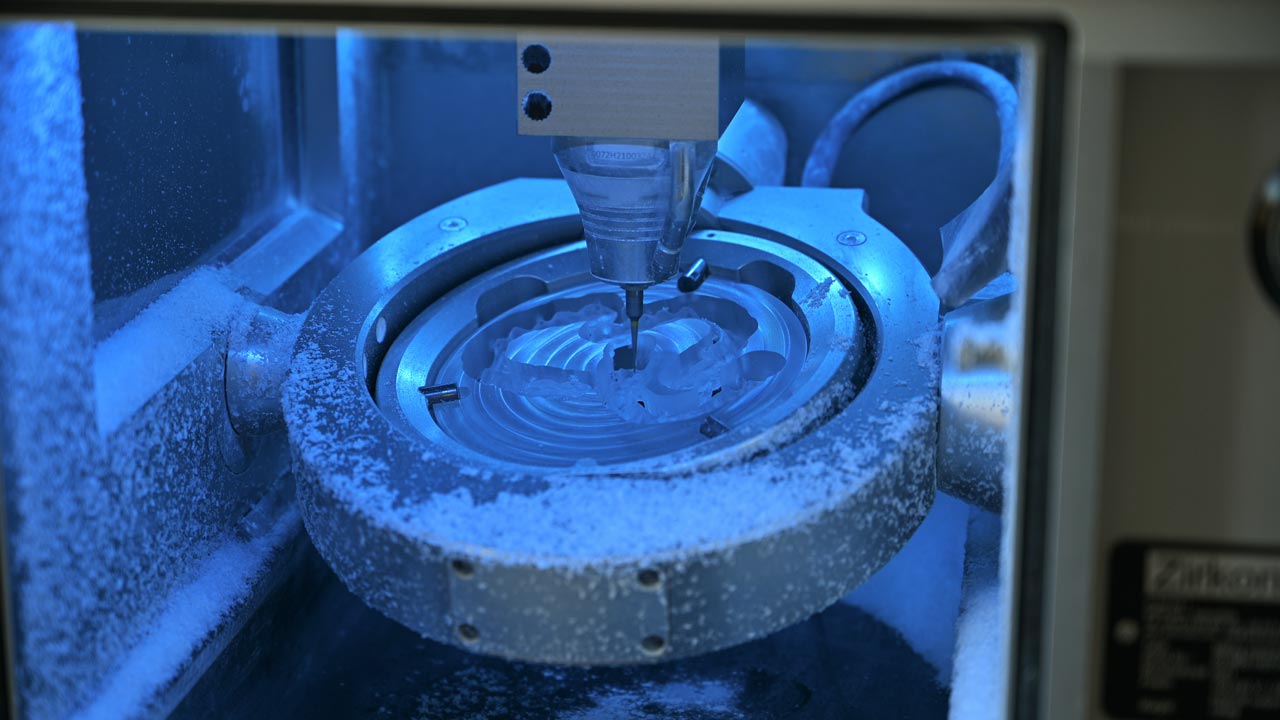 Kronen im Frontzahnbereich