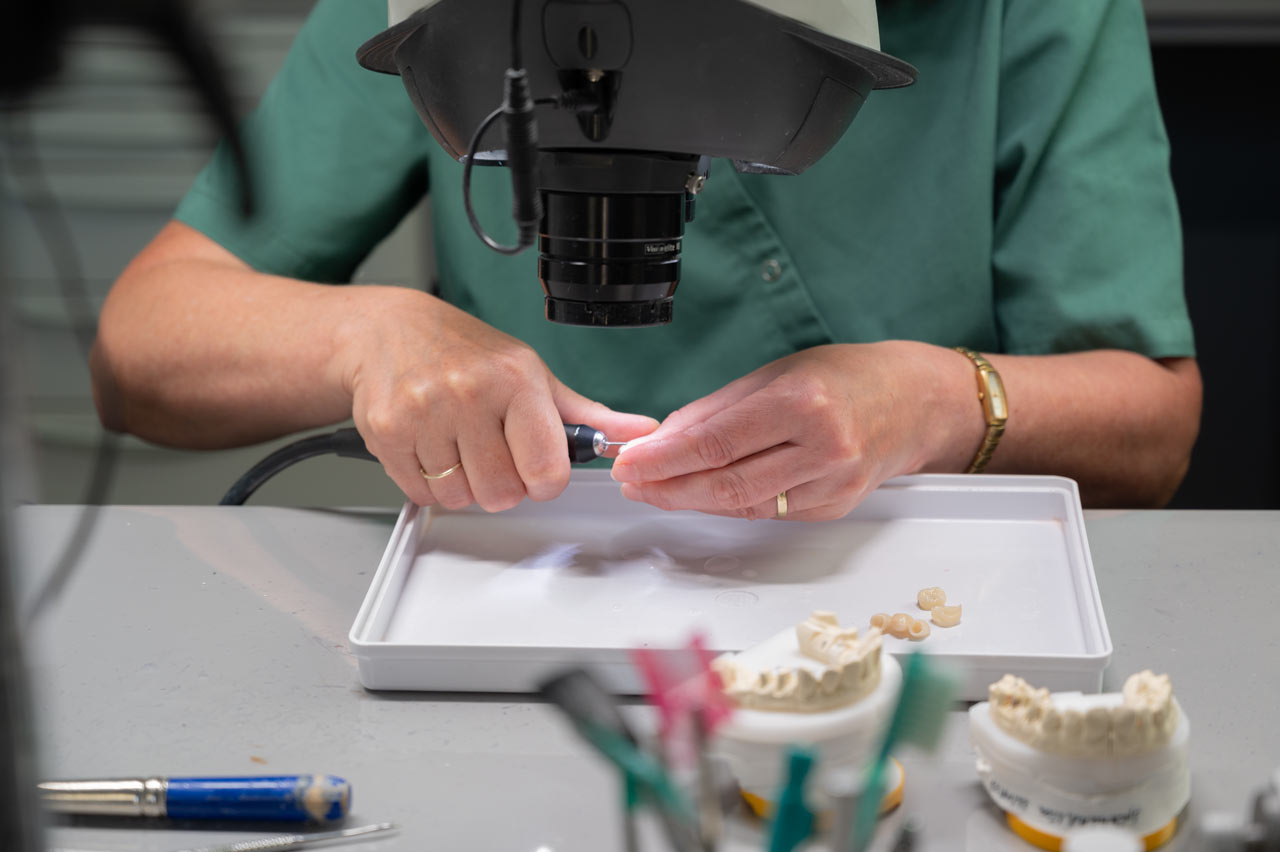 Kronen im Frontzahnbereich